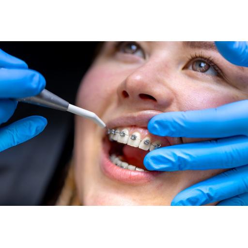 dental-procedure-installing-braces-close-up-dentistry-braces-teeth.jpg